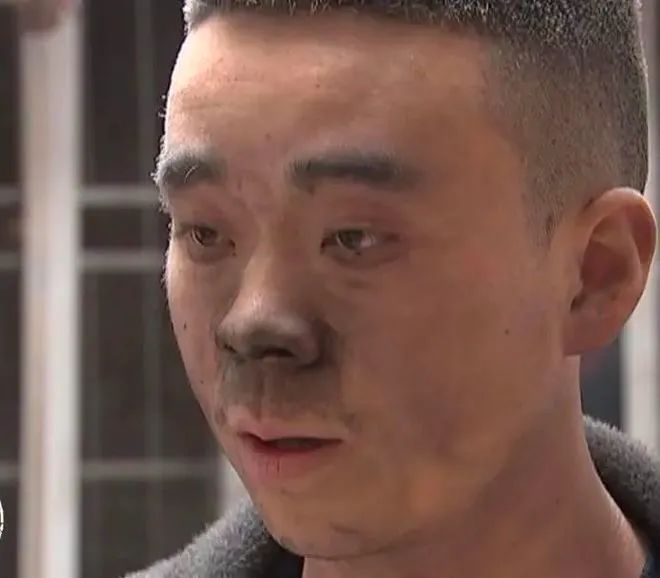 布满老茧与血泡！这是一双怎样的手啊